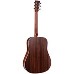 MARTIN - D-16E - ROSEWOOD